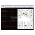 Seis lleva canal electrocardiógrafo electrocardiógrafo EKG Holter gran pantalla ECG